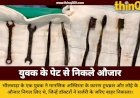 जयपुर में युवक के पेट से निकले 9 टूथब्रश और लोहे के औजार, डॉक्टर भी रह गए दंग