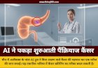 चीन में AI ने पकड़ा बिना लक्षण वाला पैंक्रियाज कैंसर: स्टीव जॉब्स की इसी बीमारी से हुई थी मौत, अलीबाबा का पांडा टूल बना लाइफसेवर